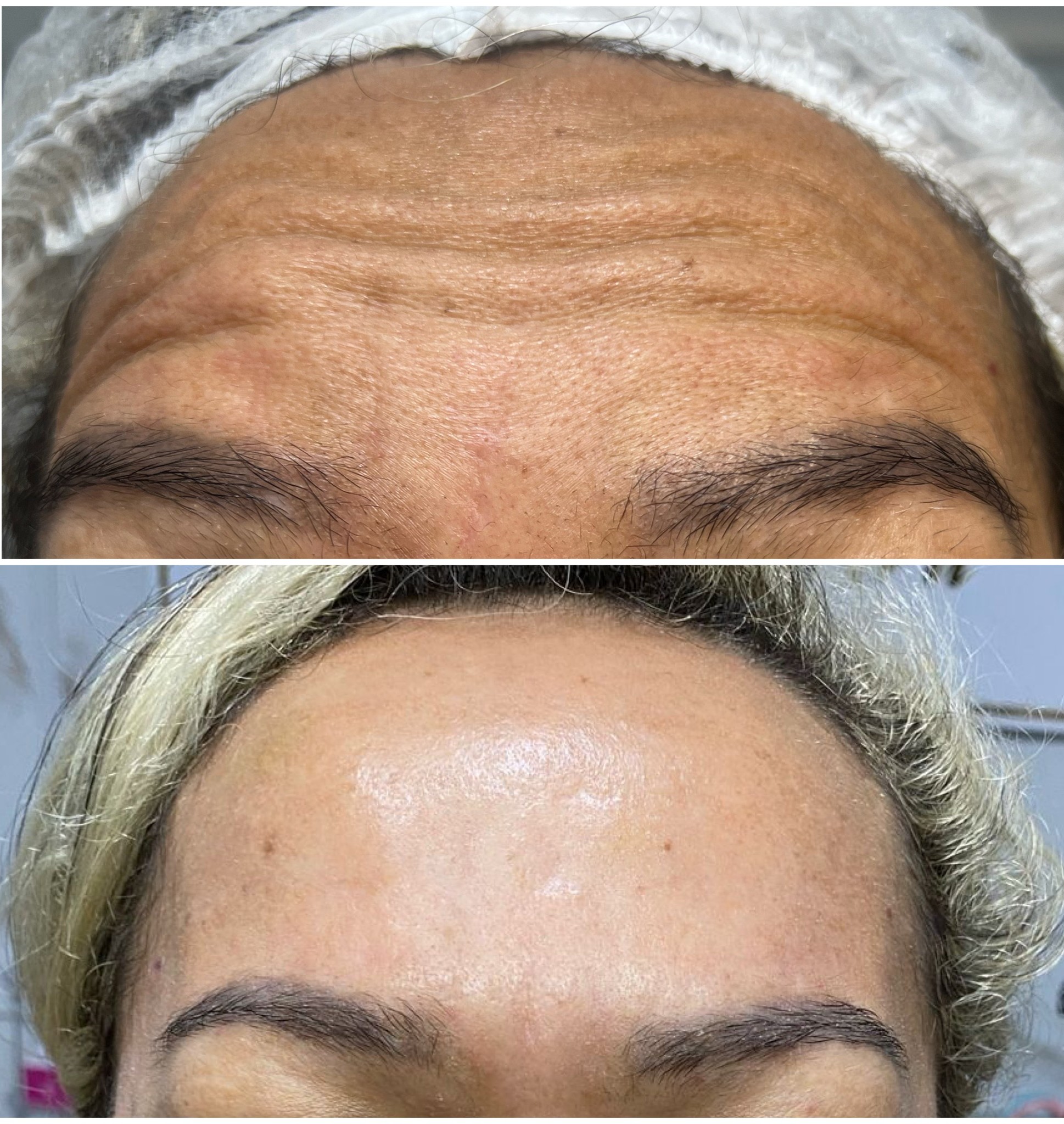 Resultados